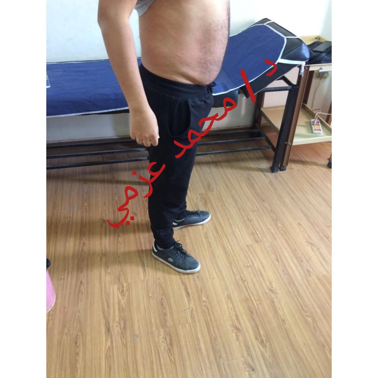 After Transformation